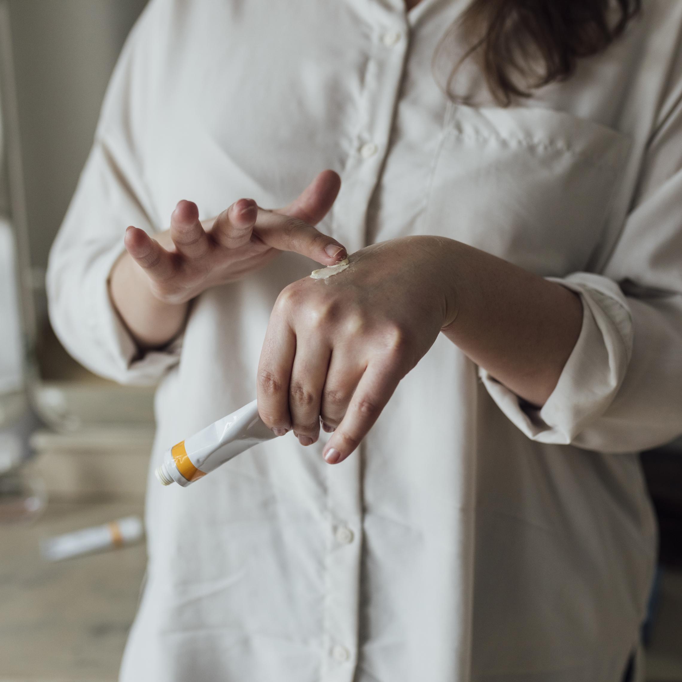 Frau mit Salbe gegen Psoriasis. Sie cremt ihre Hand ein.