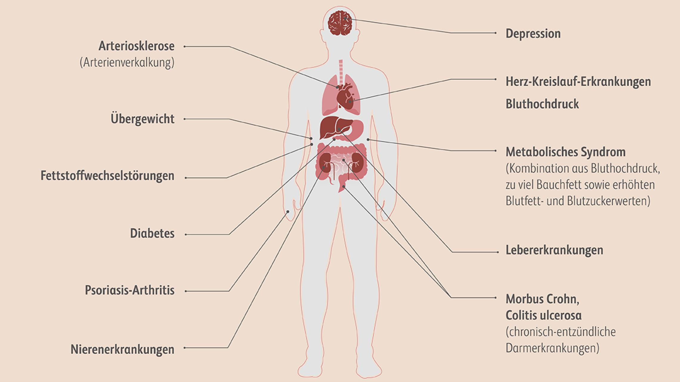 Mögliche Begleiterkrankungen bei Plaque-Psoriasis